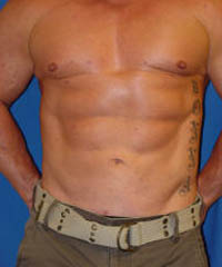 1_0007_jb_lipo7.jpg