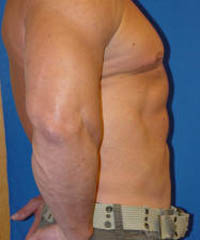 1_0009_jb_lipo4.jpg