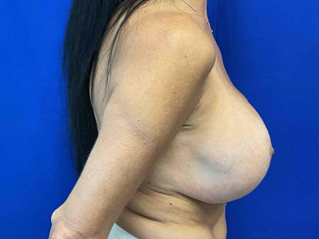 1_0003_Patient_Image 05_15_25 10_58_16_853.jpg Note- Uploaded via Nextech iPad app.pdf