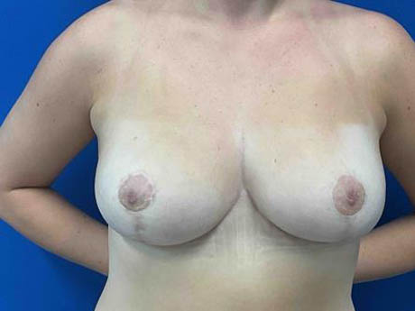 1_0001_Patient_Image 02_17_26 15_35_23_971.jpg Note- Uploaded via Nextech iPad app – Pa_Page_1_Image_0001.jpg