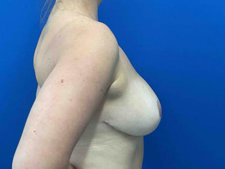 1_0003_Patient_Image 02_17_26 15_35_23_971.jpg Note- Uploaded via Nextech iPad app – Pa_Page_1_Image_0002.jpg