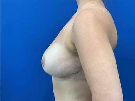 1_0007_Patient_Image 02_17_26 15_36_49_815.jpg Note- Uploaded via Nextech iPad app – Pa_Page_1_Image_0001.jpg