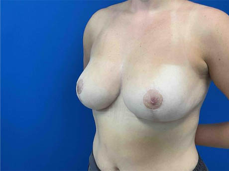 1_0009_Patient_Image 02_17_26 15_36_49_815.jpg Note- Uploaded via Nextech iPad app – Pa_Page_1_Image_0002.jpg