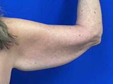 1_0002_Patient_Image 10_13_25 13_21_59_758.jpg Note- Uploaded via Nextech iPad app – Pa_Page_1_Image_0001.jpg