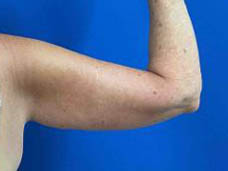 1_0003_Patient_Image 10_13_25 13_21_59_758.jpg Note- Uploaded via Nextech iPad app – Pa_Page_1_Image_0002.jpg