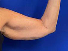 1_0006_Patient_Image 10_13_25 13_22_39_381.jpg Note- Uploaded via Nextech iPad app – Pa_Page_1_Image_0001.jpg