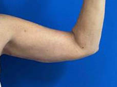 1_0007_Patient_Image 10_13_25 13_22_39_381.jpg Note- Uploaded via Nextech iPad app – Pa_Page_1_Image_0002.jpg